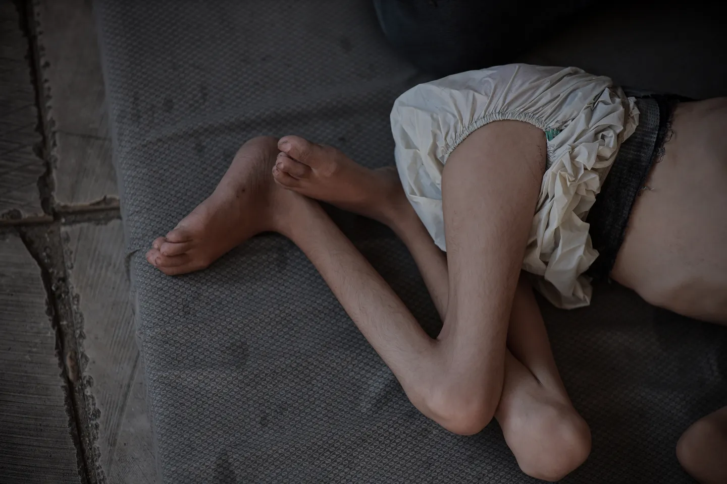 Yara was born in war and died in war: How children are starving to death in Gaza