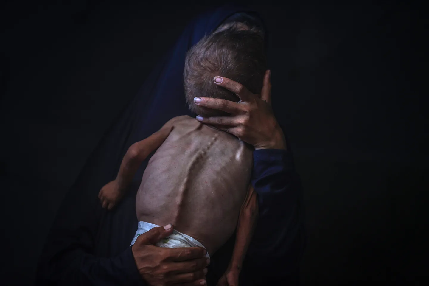Raporti i IPC-së: “Skenari më i keq i urisë” po ndodh aktualisht në Gaza