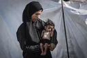 La hambruna sigue matando silenciosamente en Gaza, y los niños sufren lo peor: la alerta de la ONU