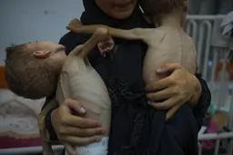 Over 100 children die from Israeli-enforced starvation in besieged Gaza: UNRWA