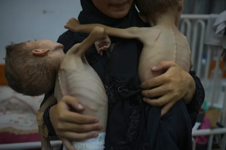 Over 100 children die from Israeli-enforced starvation in besieged Gaza: UNRWA
