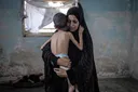 5-year-old disabled Gaza boy dies from Israel's forced starvation, weighing less than 7 pounds