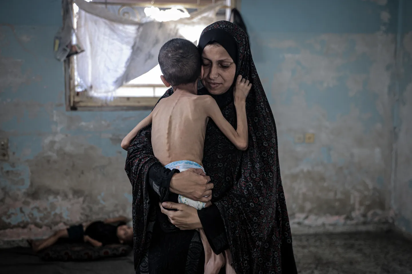 5-year-old disabled Gaza boy dies from Israel's forced starvation, weighing less than 7 pounds
