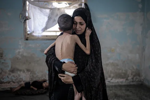 بەش ياشلىق غەززەلىك مېيىپ بالا ئىسرائىلىيەنىڭ ئاچ قويۇش سىياسىتى سەۋەبىدىن ھاياتىدىن ئايرىلدى
