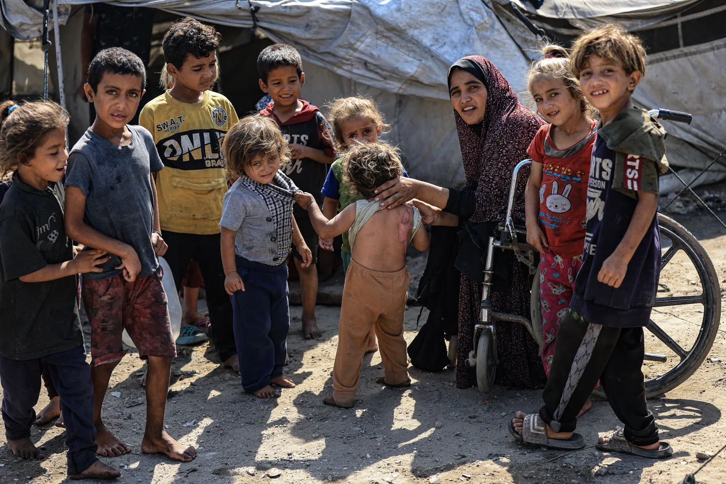 Gaza bilježi nagli porast kožnih bolesti usred jakog toplotnog talasa