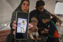 Niños desnutridos llenan hospitales de Gaza, mientras Netanyahu niega la hambruna