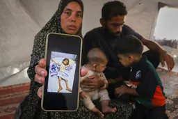 Niños desnutridos llenan hospitales de Gaza, mientras Netanyahu niega la hambruna