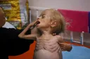 Türkiye warns unpunished war crimes fuel Israel’s recklessness as Gaza famine intensifies