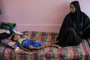 “Demasiado débiles para llorar”: el hambre consume a los niños mientras Israel arrasa Ciudad de Gaza
