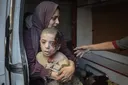 ОН: Повеќе од 21.000 палестински деца станале инвалиди од почетокот на војната во Газа