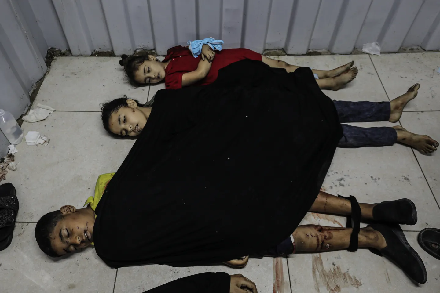 Israeli genocide ravages Gaza children; hunger, amputations, trauma soar