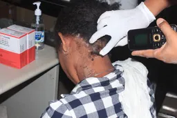 Cutar kuturta a Afirka: Yanzu ne lokacin sauya lamarin