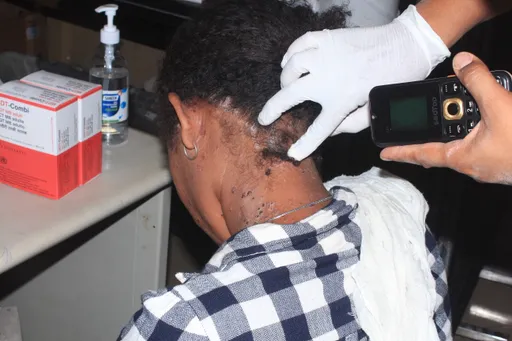 Africa and Leprosy: Changing the story, now