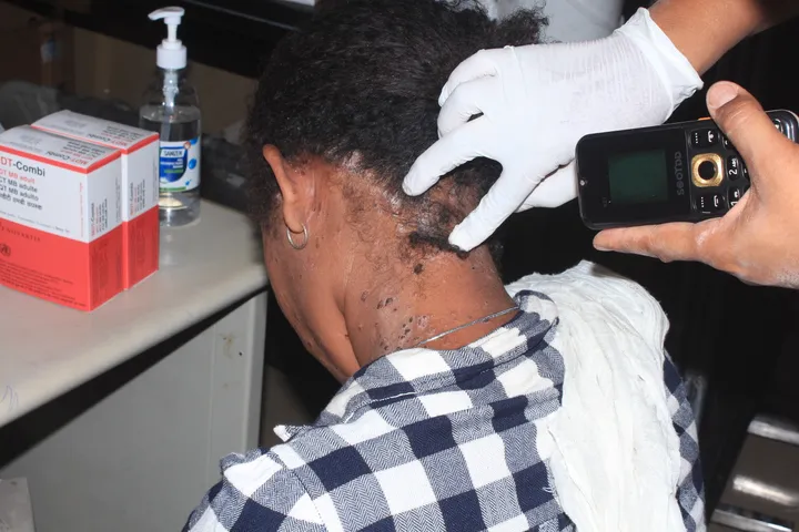 Africa and Leprosy: Changing the story, now