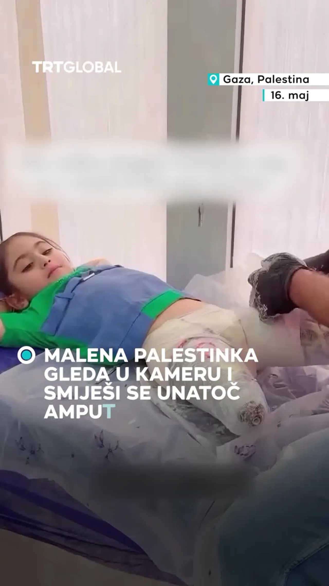 Djevojčica s amputacijom gleda u kameru i smiješi se