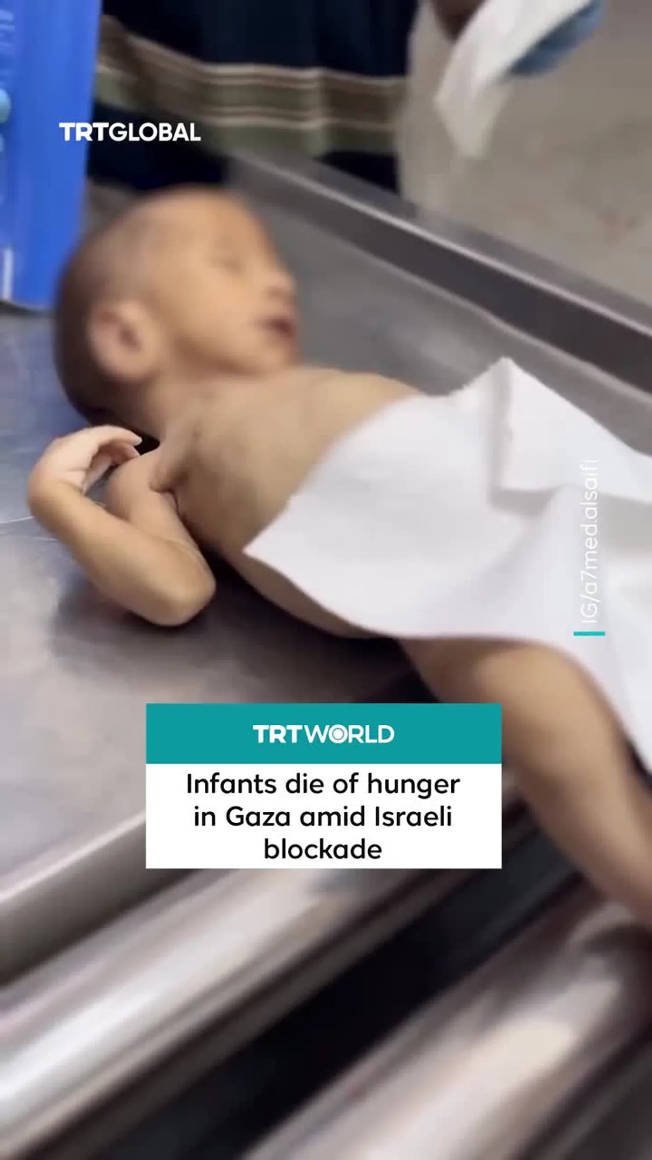 Two children, including 40-day-old infant, die from malnutrition in Gaza