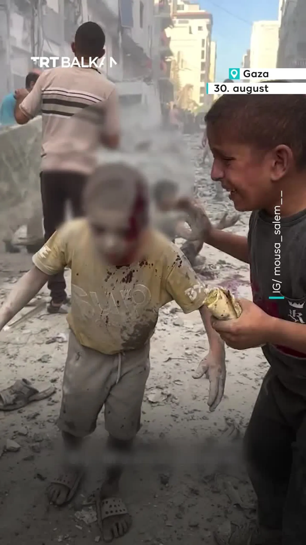 Krvavi maleni Palestinac u šoku nakon izraelskog napada