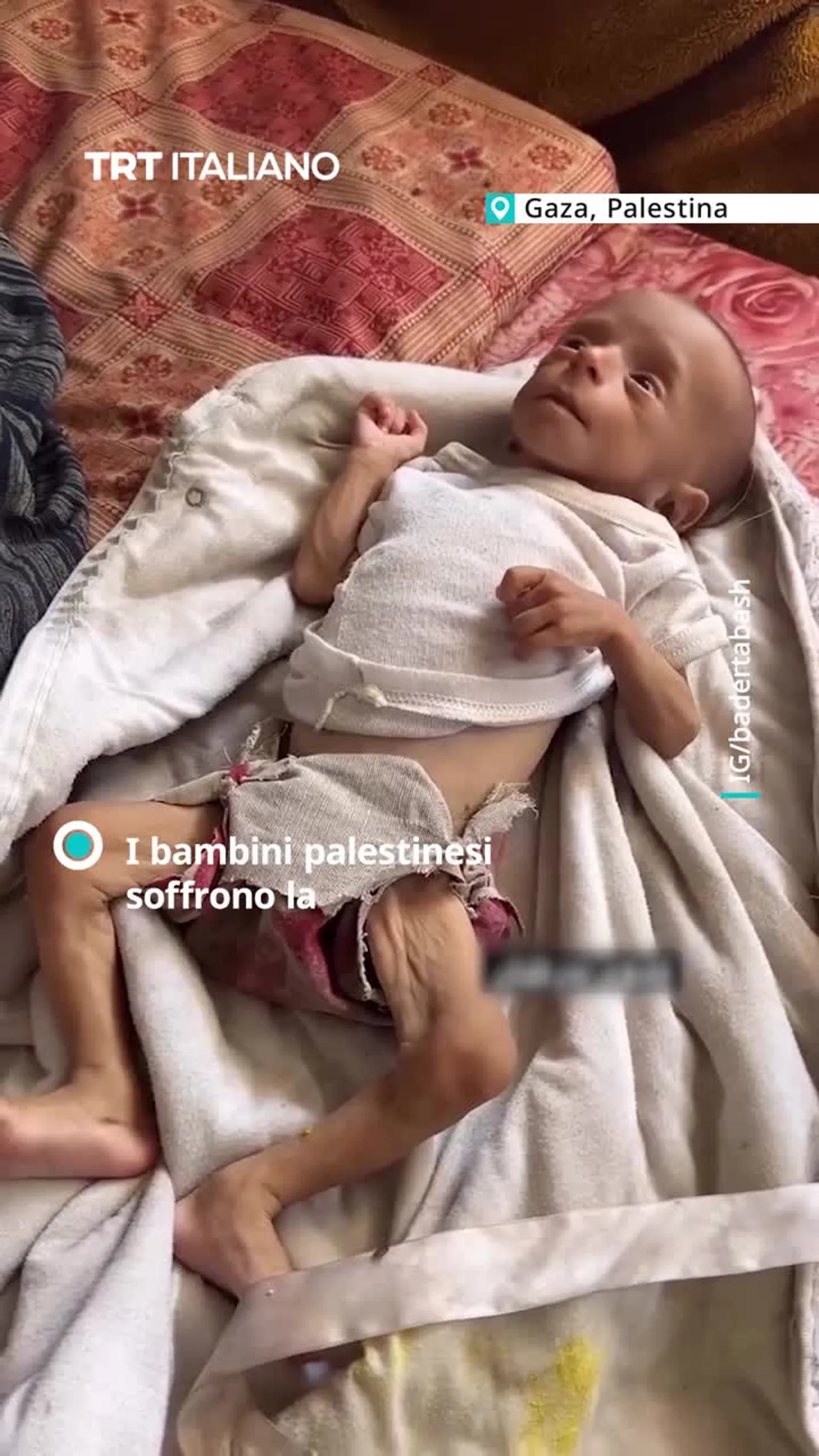 Migliaia di bambini che a Gaza vivono nella fame