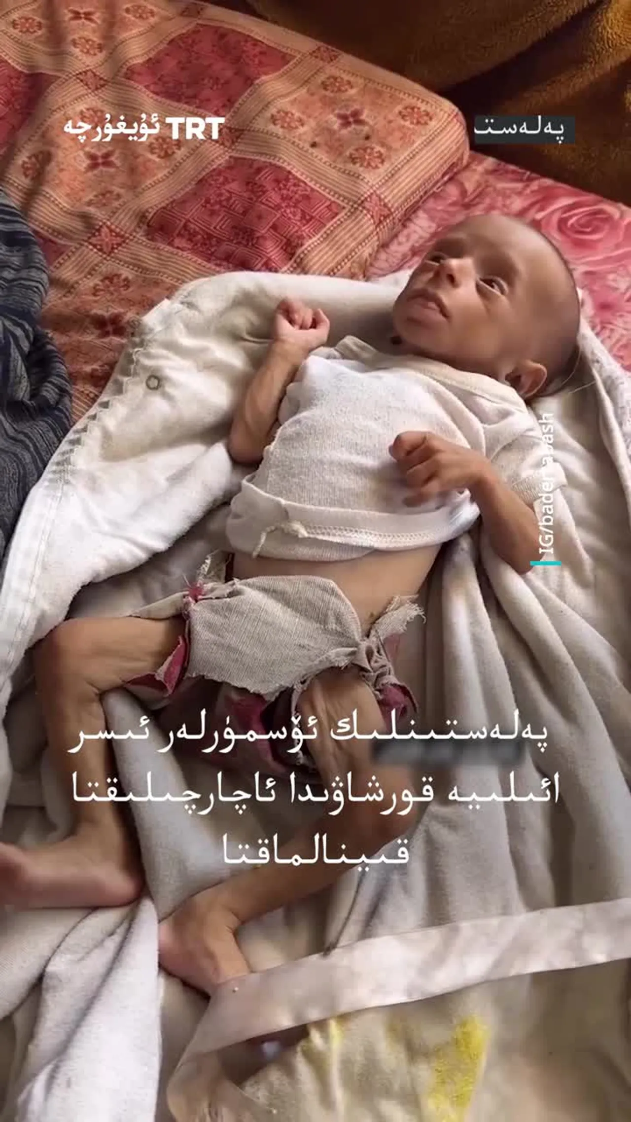 پەلەستىنلىك ئۆسمۈرلەر ئىسرائىلىيە قورشاۋىدا ئاچارچىلىقتا قىينالماقتا