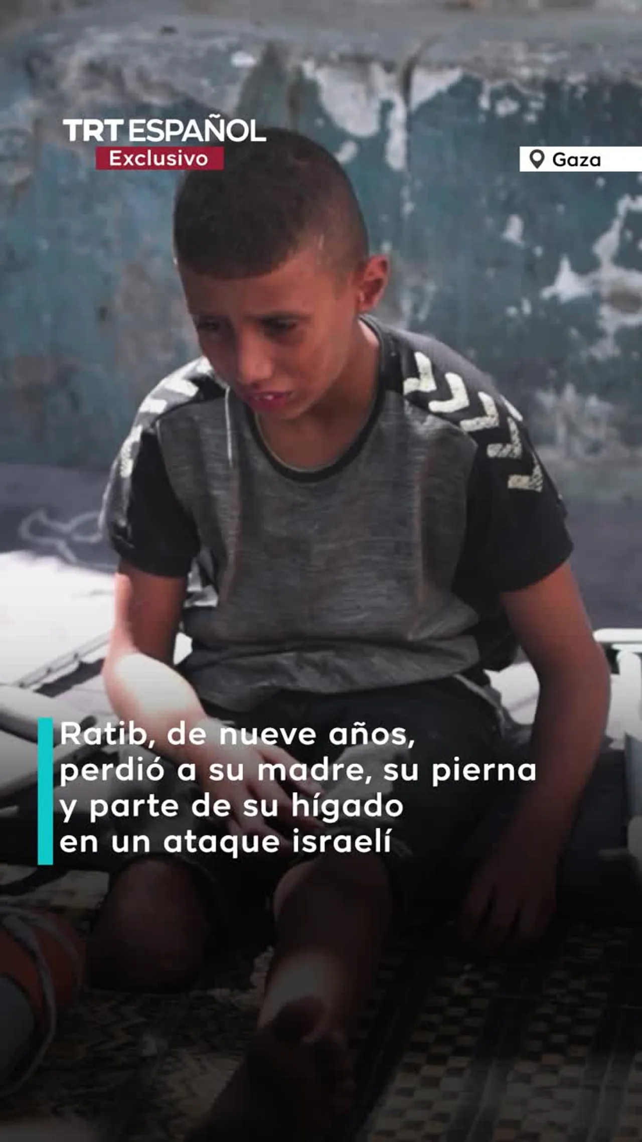 Perdió su pierna, pero no la esperanza - Ratib, niño palestino