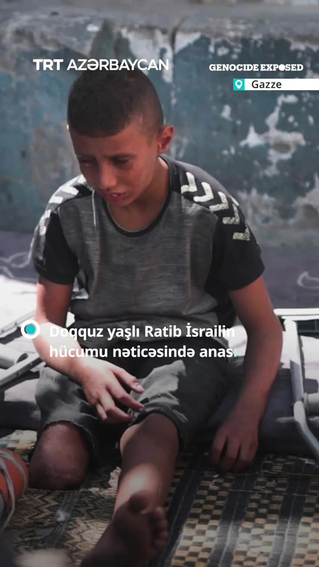 Ayağı amputasiya edilsə də, ümidini heç vaxt itirməyib