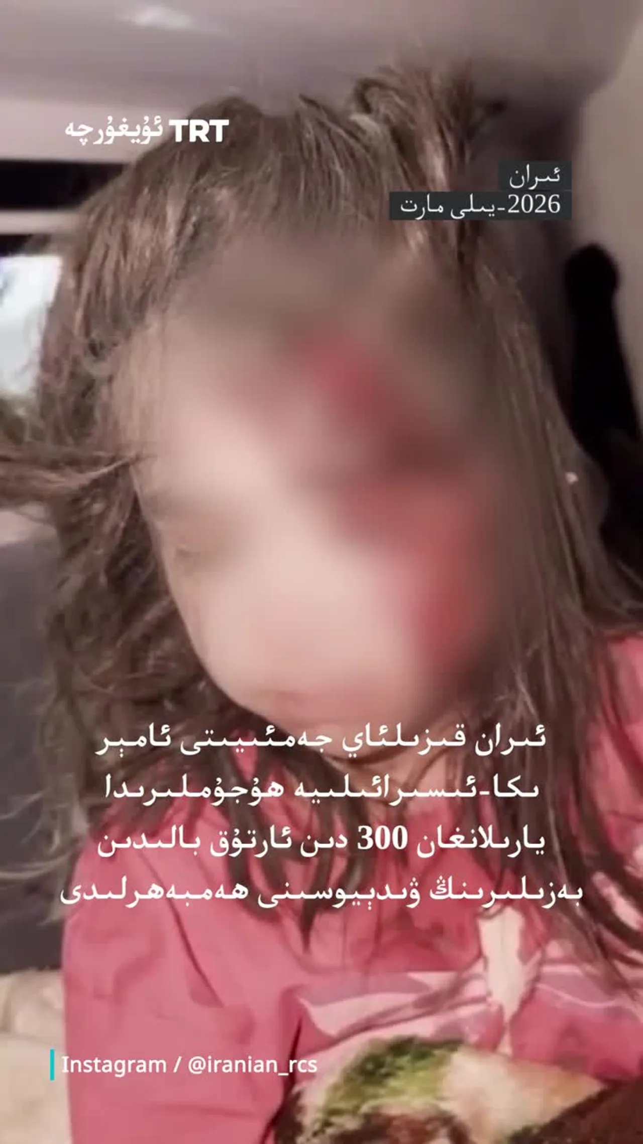 ئىران قىزىلئاي جەمئىيىتى يارىلانغان بالىلارنىڭ ۋىدېيوسىنى ھەمبەھرلىدى