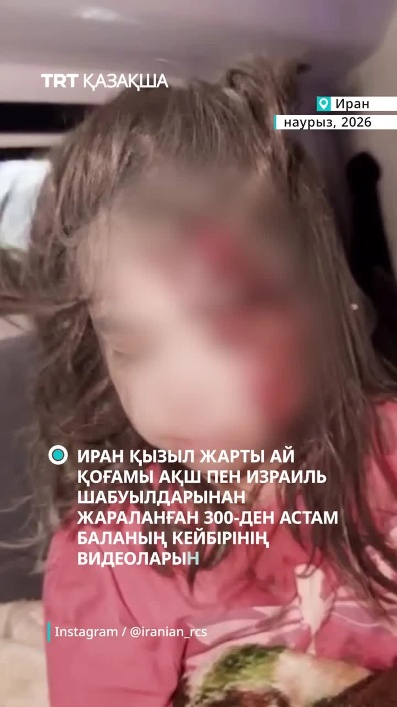 АҚШ пен Израиль шабуылдарынан жараланған 300-ден астам баланың кейбірінің видеолары жарияланды