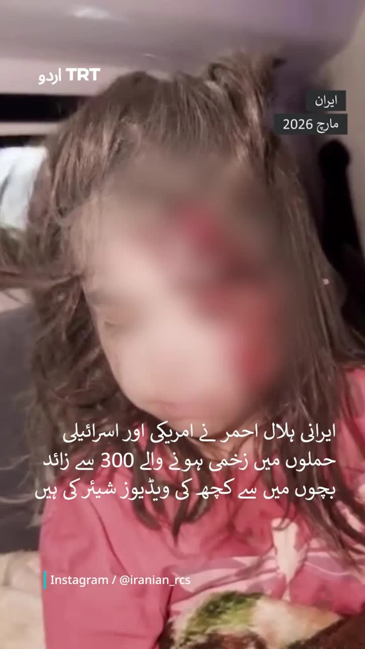 ایرانی ہلال احمر: امریکی اور اسرائیلی حملوں میں زخمی ہونے والے 300 سے زائد بچوں میں سے کچھ کی ویڈیوز