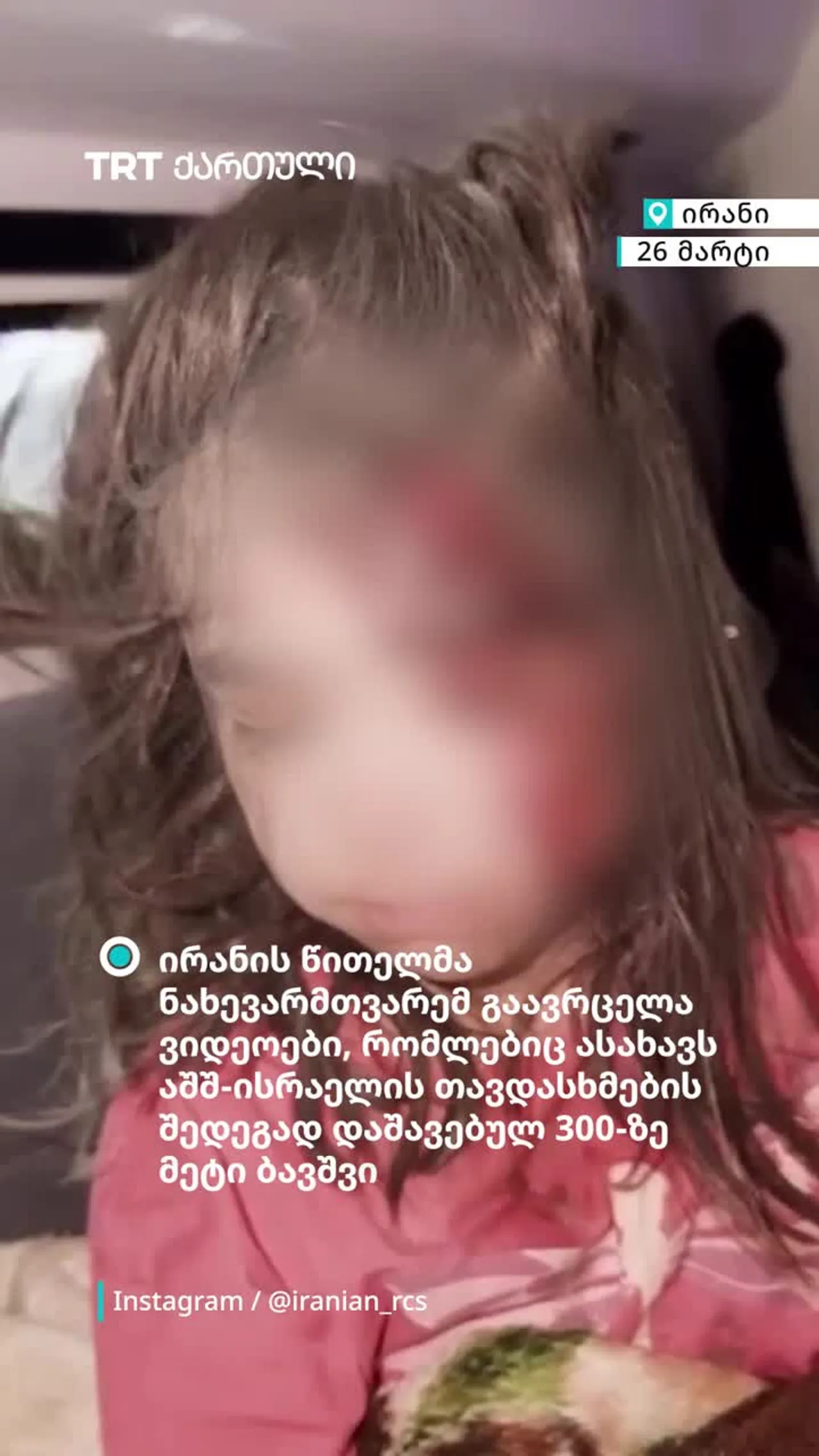 ირანის წითელმა ნახევარმთვარემ თავდასხმებისას დაშავებული ბავშვების ვიდეოკადრები გაავრცელა