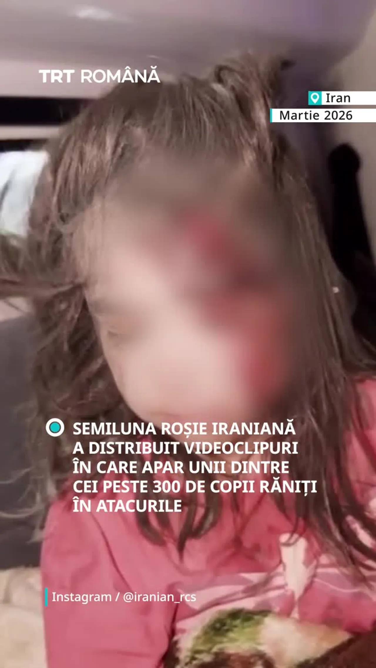 Semiluna Roșie Iraniană a distribuit videoclipuri cu copiii răniți în atacurile SUA- Israel