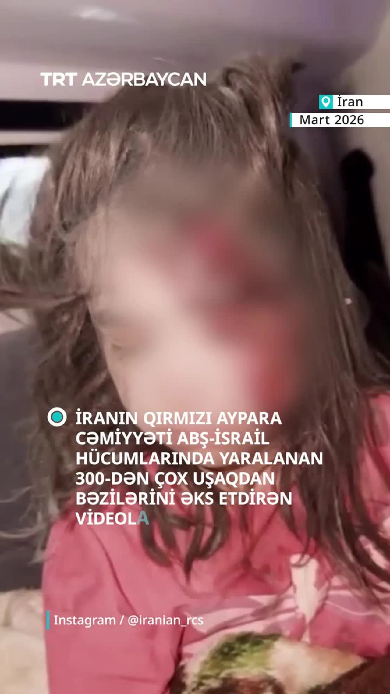 İran Qırmızı Aypara Cəmiyyəti yaralı uşaqların görüntülərini paylaşdı