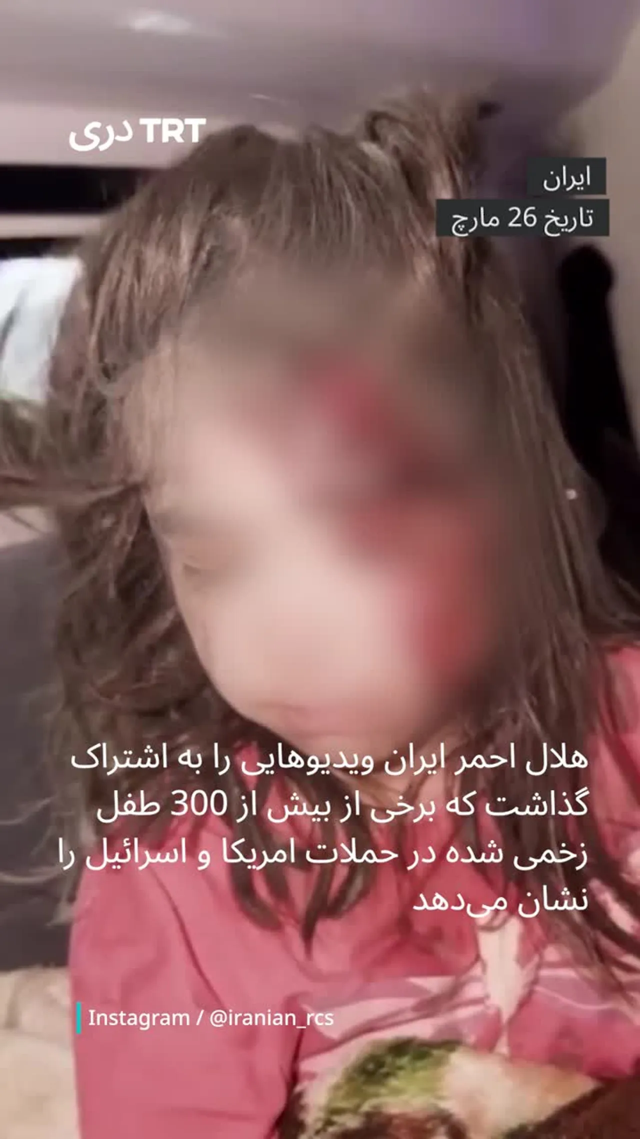 تصاویر ویدیویی از کودکان زخمی شده در ایران در نتیجه حملات امریکا و اسرائیل