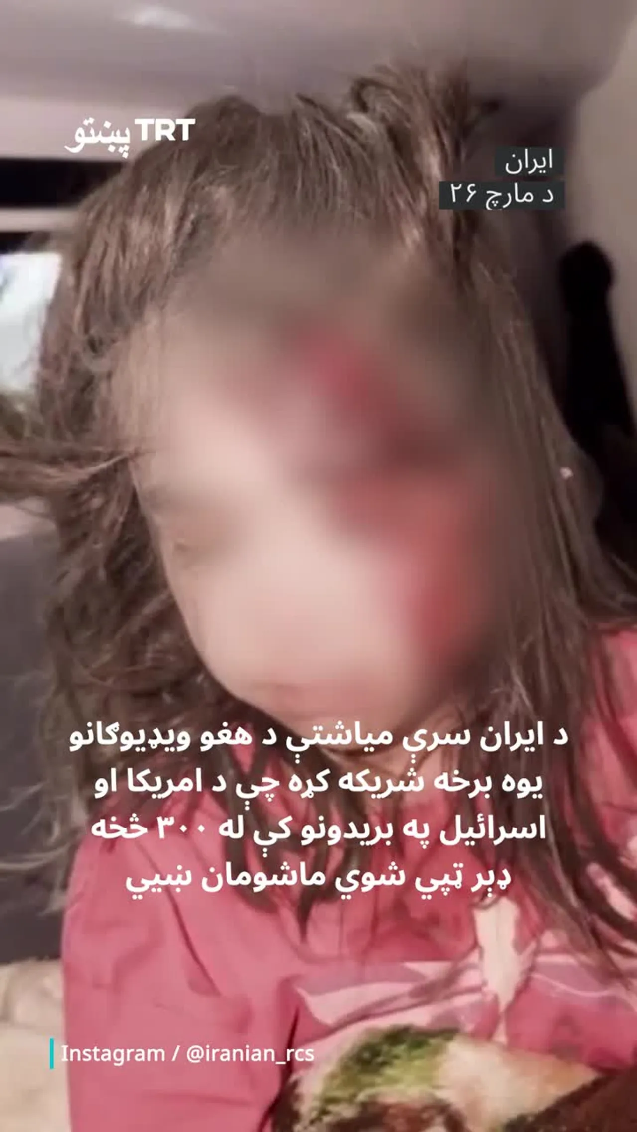 د ایران سرې میاشتې د اسرائیل او امریکا په بریدونو کې د سلګونو تنو ماشومانو د وژل کیدو ویدیو خپره کړه