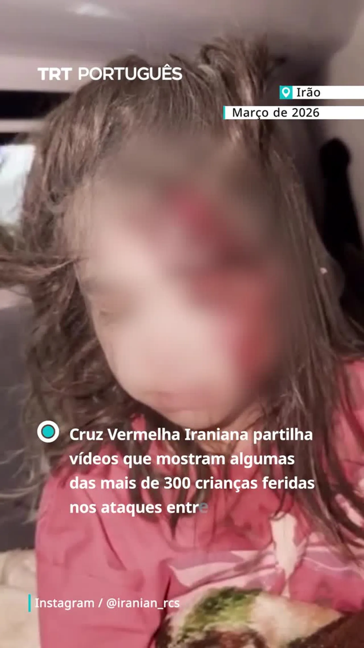 Cruz Vermelha Iraniana divulga vídeos mostrando algumas das crianças feridas em ataques EUA-Israel