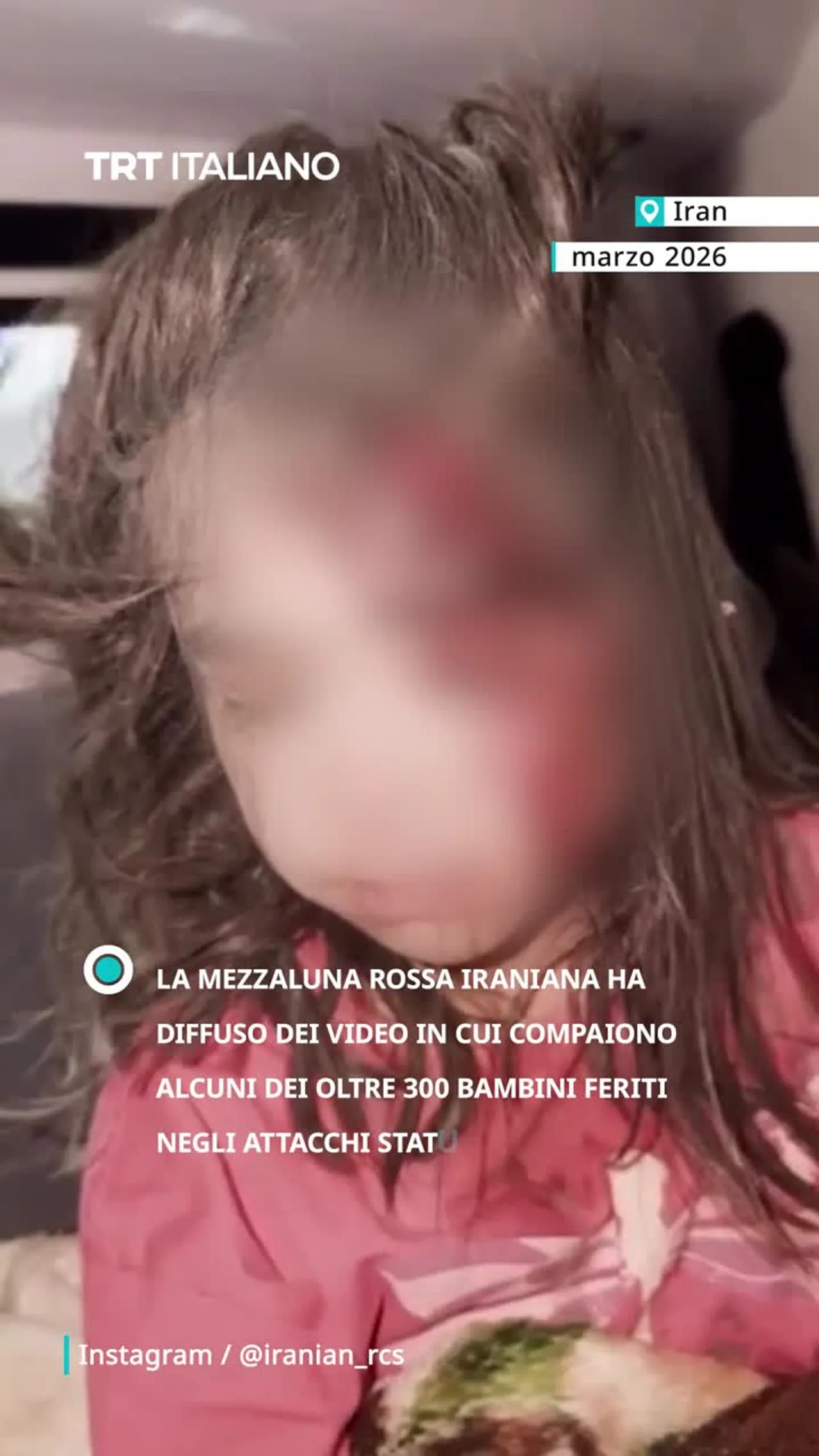 La Mezzaluna Rossa iraniana ha condiviso alcuni video che mostrano alcuni bambini feriti