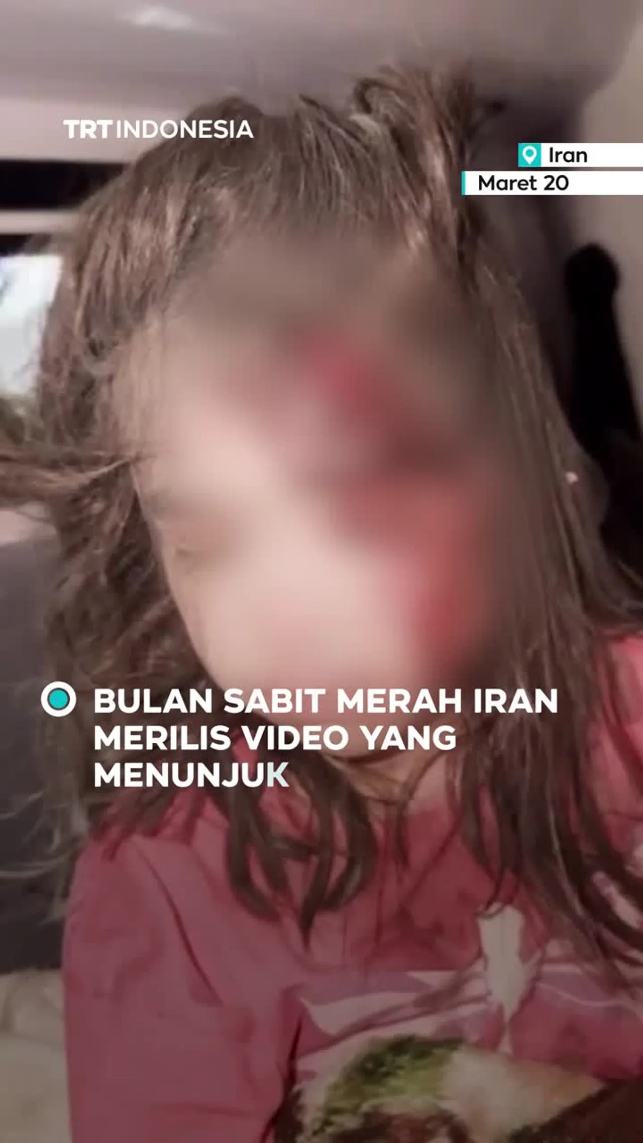 Bulan Sabit Merah Iran rilis video anak-anak korban serangan AS–Israel, korban tewas 1.230 orang